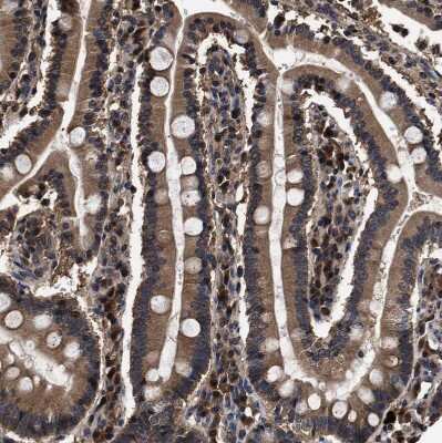 Immunohistochemistry-Paraffin: ZNF313 Antibody [NBP1-87204]