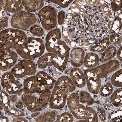 Immunohistochemistry-Paraffin: ZNF313 Antibody [NBP1-87204]