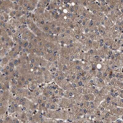 Immunohistochemistry-Paraffin: ZNF313 Antibody [NBP1-87204]