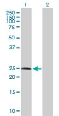 Western Blot: ZNF313 Antibody [H00055905-D01P]