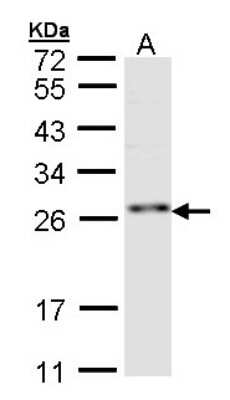 Western Blot: ZNF313 Antibody [NBP1-32661]