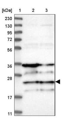 Western Blot: ZNF313 Antibody [NBP1-87204]