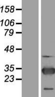 Western Blot: ZNF313 Overexpression Lysate [NBL1-15413]