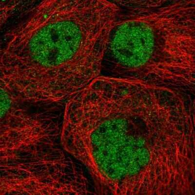 Immunocytochemistry/ Immunofluorescence: ZNF317 Antibody [NBP2-58269]