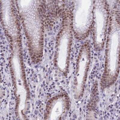 Immunohistochemistry-Paraffin: ZNF317 Antibody [NBP1-86220]