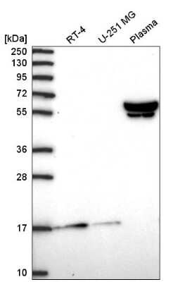 Western Blot: ZNF317 Antibody [NBP2-58269]