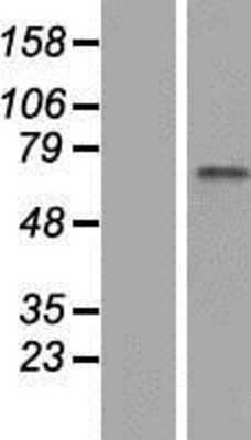 Western Blot: ZNF317 Overexpression Lysate [NBP2-06595]