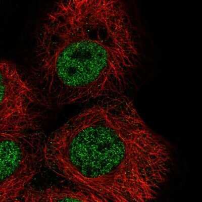 Immunocytochemistry/ Immunofluorescence: ZNF318 Antibody [NBP1-83208]