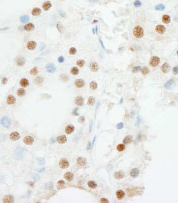 Immunohistochemistry: ZNF318 Antibody [NB100-77289]
