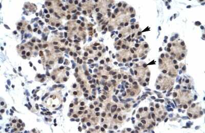 Immunohistochemistry: ZNF318 Antibody [NBP3-10946]