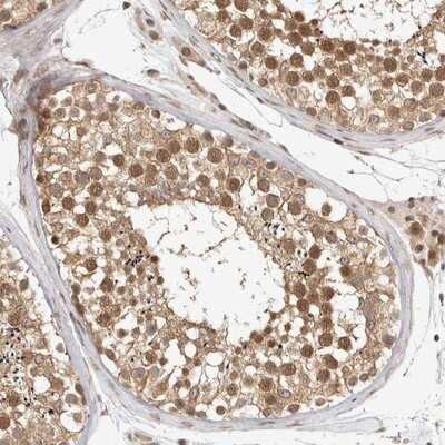 Immunohistochemistry-Paraffin: ZNF318 Antibody [NBP1-83208]