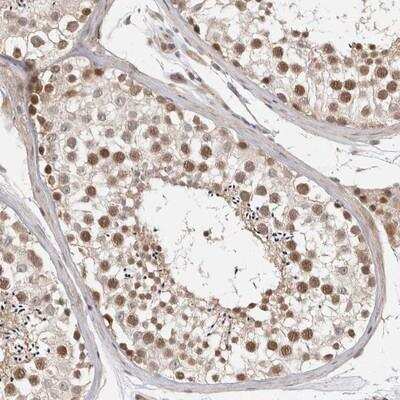 Immunohistochemistry-Paraffin: ZNF318 Antibody [NBP1-83209]