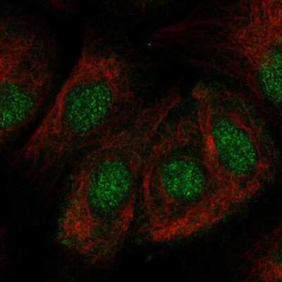 Immunocytochemistry/ Immunofluorescence: ZNF319 Antibody [NBP2-47566]