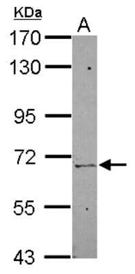 Western Blot: ZNF319 Antibody [NBP2-20989]