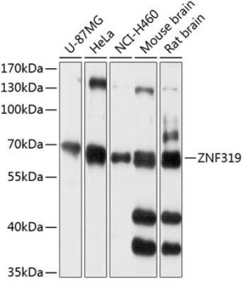 Western Blot: ZNF319 AntibodyAzide and BSA Free [NBP2-93261]