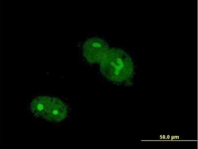 Immunocytochemistry/ Immunofluorescence: ZNF32 Antibody [H00007580-B01P]