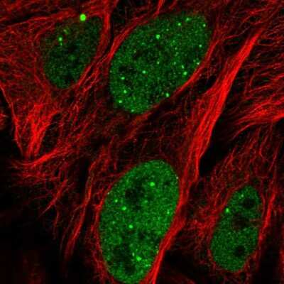 Immunocytochemistry/ Immunofluorescence: ZNF32 Antibody [NBP2-55012]