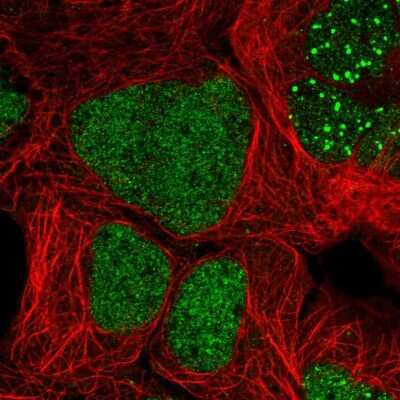 Immunocytochemistry/ Immunofluorescence: ZNF32 Antibody [NBP2-55945]