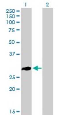 Western Blot: ZNF32 Antibody [H00007580-B01P]