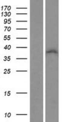 Western Blot: ZNF32 Overexpression Lysate [NBP2-07550]