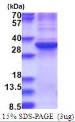 SDS-PAGE: Recombinant Human ZNF32 His Protein [NBP2-51720]