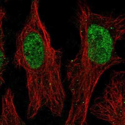 Immunocytochemistry/ Immunofluorescence: ZNF320 Antibody [NBP2-68791]