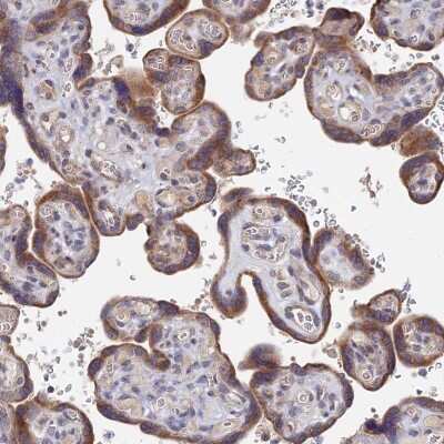 Immunohistochemistry-Paraffin: ZNF320 Antibody [NBP1-84114]