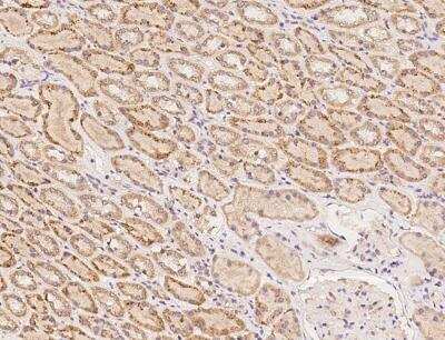 Immunohistochemistry-Paraffin: ZNF320 Antibody [NBP3-05853]