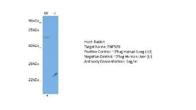 Western Blot: ZNF320 Antibody [NBP2-86473]