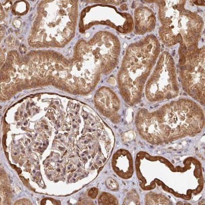 Immunohistochemistry: ZNF322A Antibody [NBP2-32047]