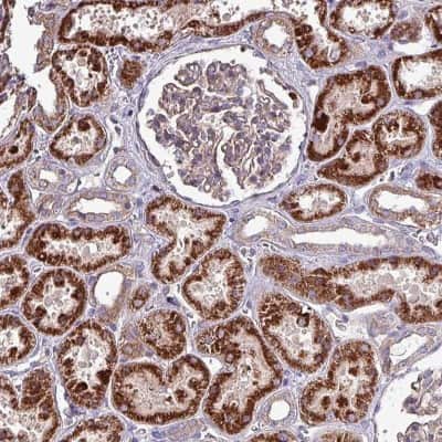 Immunohistochemistry: ZNF322A Antibody [NBP2-33384]