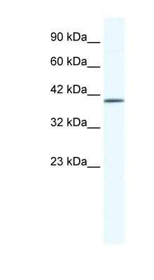 Western Blot: ZNF322A Antibody [NBP1-80123]