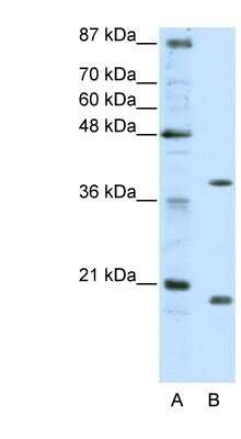 Western Blot: ZNF322A Antibody [NBP1-80365]