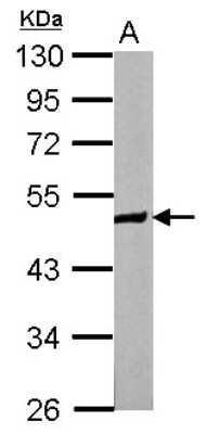 Western Blot: ZNF322A Antibody [NBP2-20990]