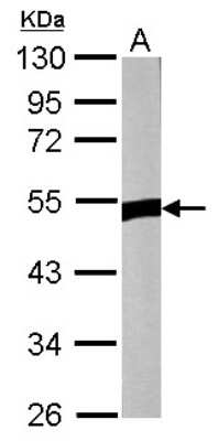 Western Blot: ZNF322A Antibody [NBP2-20990]