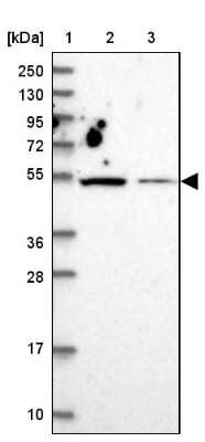 Western Blot: ZNF322A Antibody [NBP2-33384]