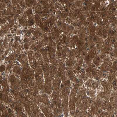 Immunohistochemistry-Paraffin: ZNF323 Antibody [NBP1-80594]