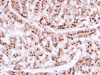 Immunohistochemistry-Paraffin: ZNF323 Antibody [NBP2-20991]