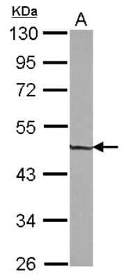 Western Blot: ZNF323 Antibody [NBP2-20991]