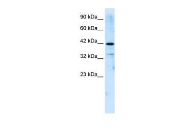 Western Blot: ZNF323 Antibody [NBP2-88664]