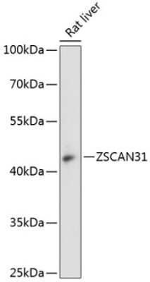 Western Blot: ZNF323 AntibodyAzide and BSA Free [NBP2-93208]