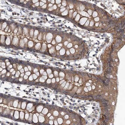Immunohistochemistry-Paraffin: ZNF324 Antibody [NBP1-86836]