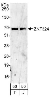 Western Blot: ZNF324 Antibody [NBP1-78183]