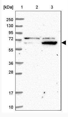 Western Blot: ZNF324 Antibody [NBP1-86836]