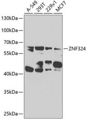 Western Blot: ZNF324 AntibodyBSA Free [NBP2-93644]