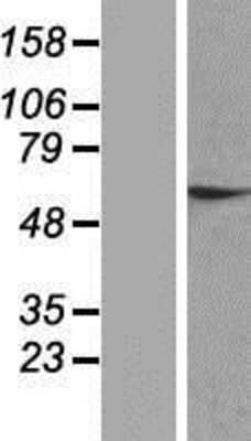 Western Blot: ZNF324 Overexpression Lysate [NBP2-07350]