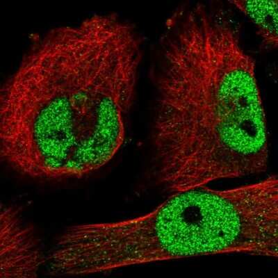 Immunocytochemistry/ Immunofluorescence: ZNF326 Antibody [NBP1-83657]