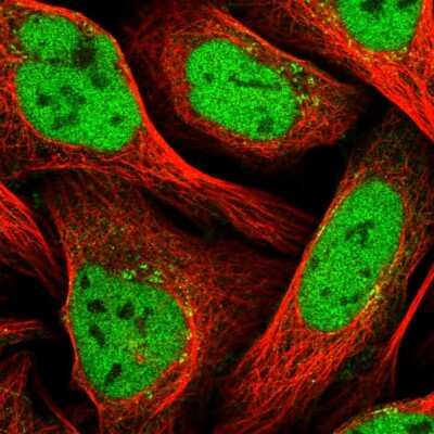 Immunocytochemistry/ Immunofluorescence: ZNF326 Antibody [NBP1-83658]