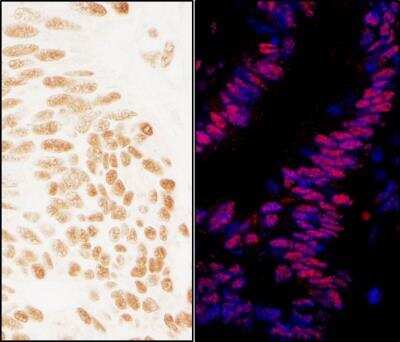 Immunohistochemistry-Paraffin: ZNF326 Antibody [NBP1-03343]