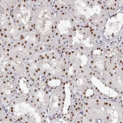 Immunohistochemistry-Paraffin: ZNF326 Antibody [NBP1-83657]